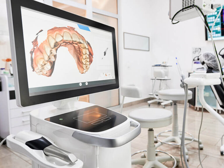 digital scan of teeth on CEREC screen